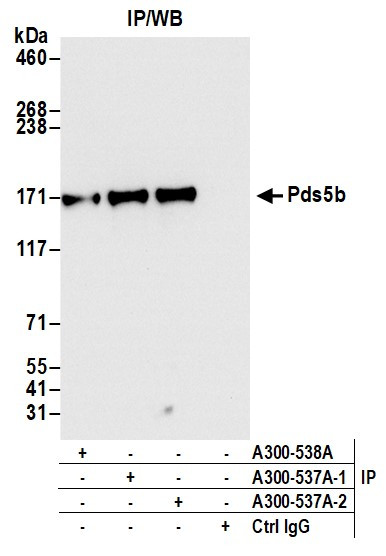 Anti-Pds5B