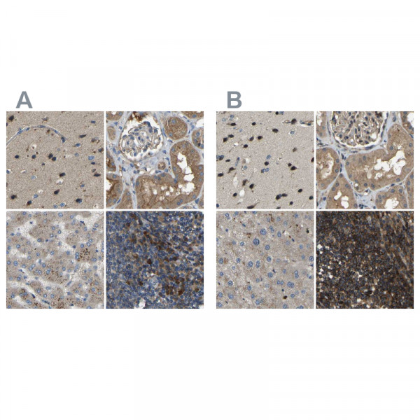 Anti-ATP8B1