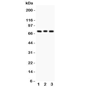 Anti-PKC beta 1