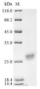 Protein RRP5 homolog (PDCD11), partial, human, recombinant