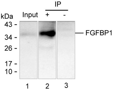Anti-FGFBP1