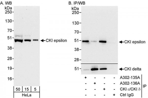 Anti-CKI epsilon