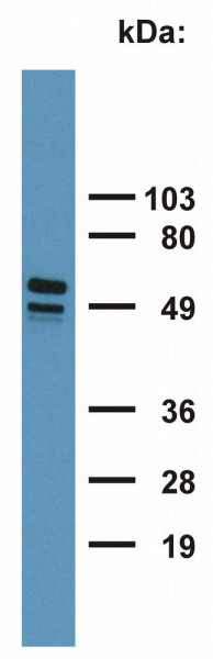 Anti-Cytokeratin 7 + 17, clone C-46
