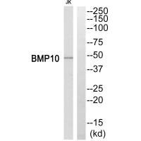 Anti-BMP10