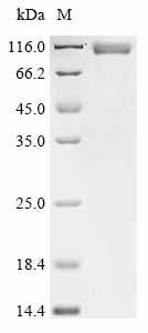 Pre-glycoprotein polyprotein GP complex (GPC), partial, recombinant Mopeia virus