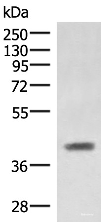 Anti-SAMSN1