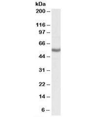 Anti-ALDH3B1