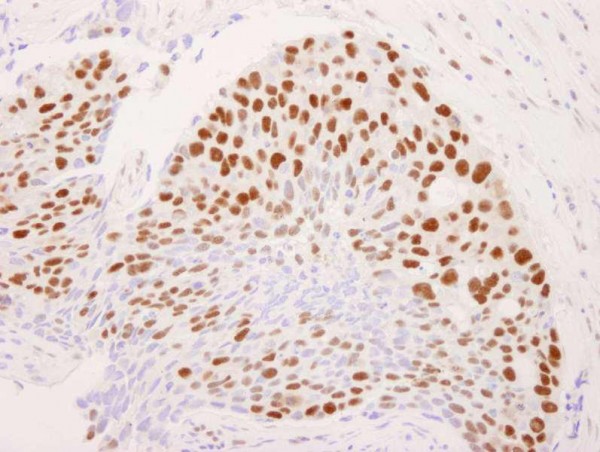 Anti-CoREST (IHC)