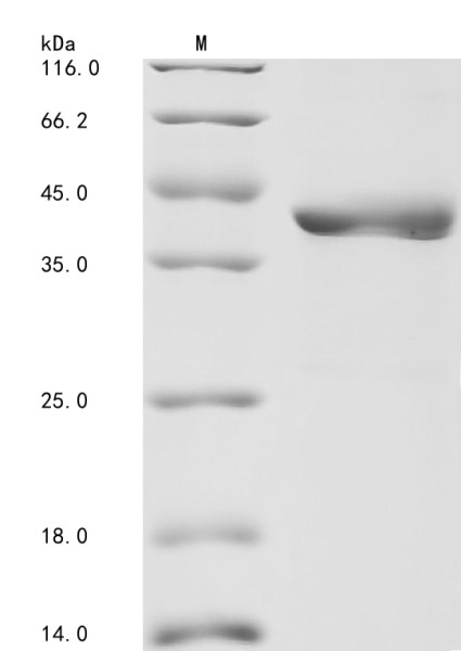 Gamma-glutamyl hydrolase (GGH), partial, human, recombinant