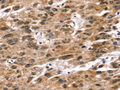 Anti-SNTA1