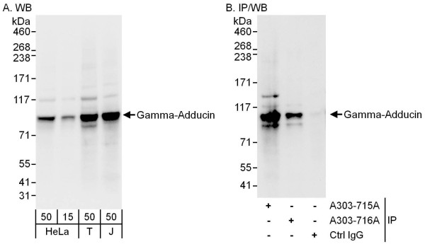 Anti-Gamma-Adducin