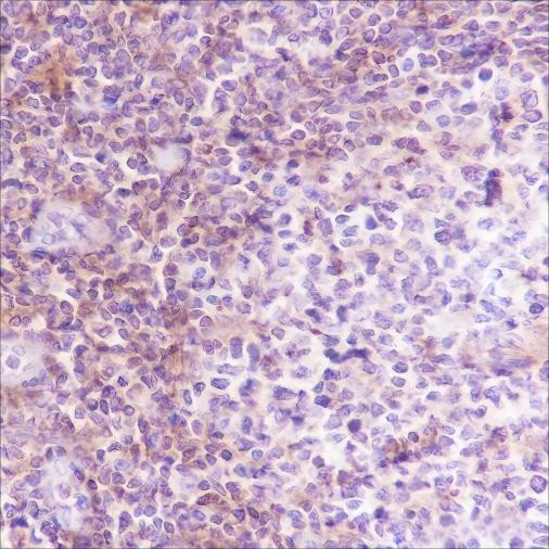 Anti-Recombinant VPAC2, clone A391