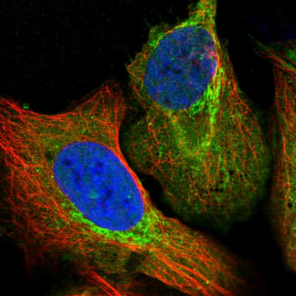 Anti-ALDH1B1
