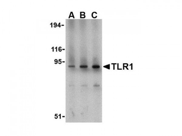 Anti-TLR1 (Toll Like Receptor-1)