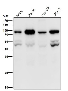 Anti-PSIP1 / PC4 and SFRS1-interacting protein / LEDGF, clone 31P66