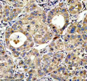 Anti-TOP1MT / DNA topoisomerase 1 mitochondrial