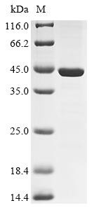 Protein SSX1 (SSX1), human, recombinant