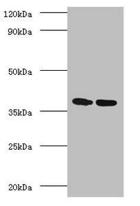 Anti-fbpA
