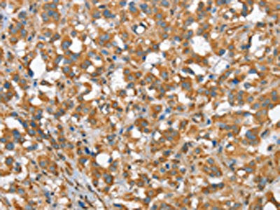 Anti-CSMD1