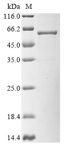 Kita-kyushu lung cancer antigen 1 (CT83), partial, Biotinylated, human, recombinant