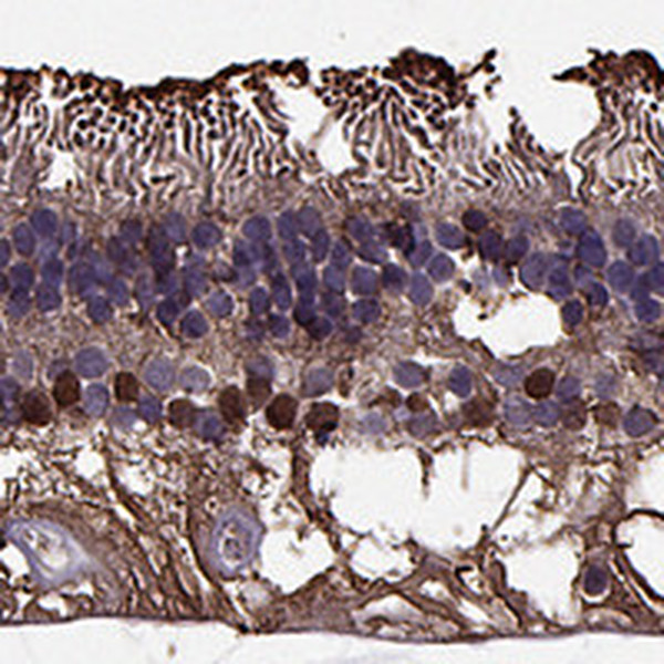 Anti-RLBP1