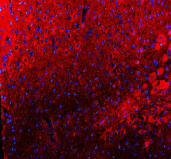Anti-TIGAR / TP53-induced glycolysis and apoptosis regulator