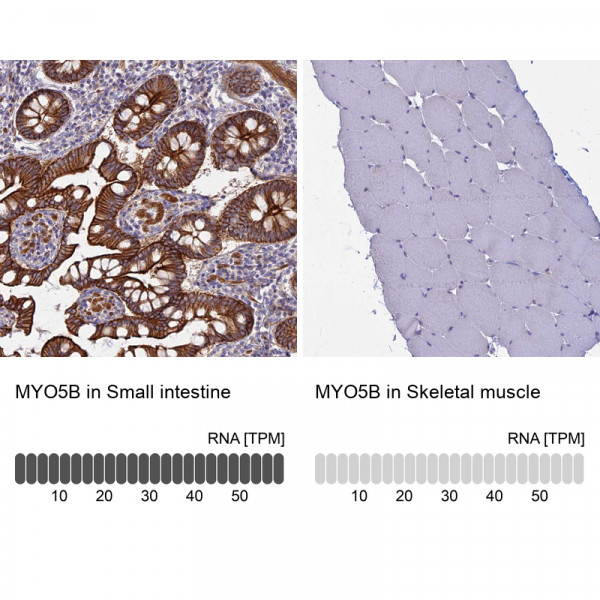 Anti-MYO5B