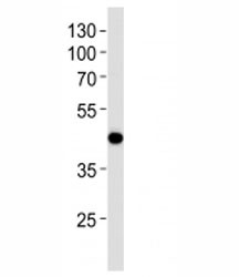 Anti-AIM2, clone 812CT9.2.2.1