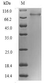 RNA-binding motif protein, Y chromosome, family 1 member F/J (RBMY1F), human, recombinant
