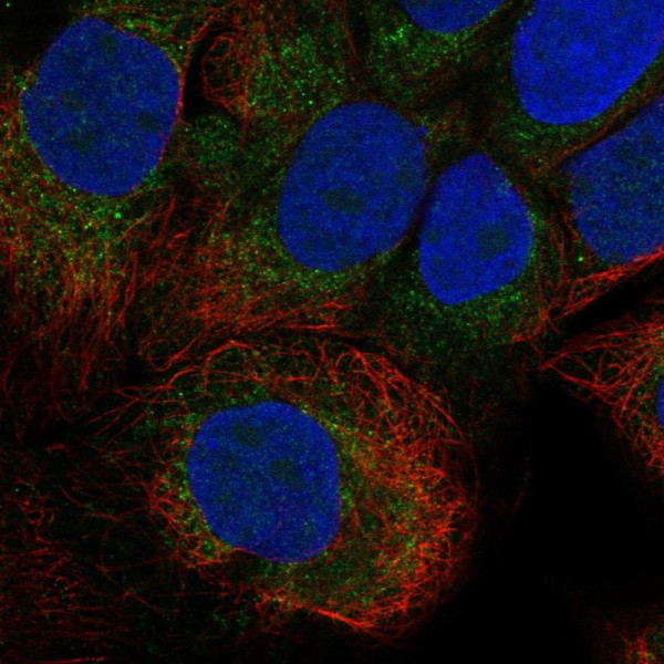Anti-CDH24