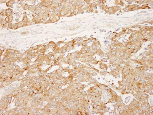 Anti-Reticulocalbin-1 (IHC)