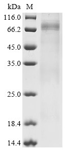 Dihydrolipoyllysine-residue acetyltransferase component of pyruvate dehydrogenase complex, mitochond