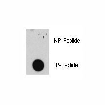 Anti-phospho-E2F1 (Ser332)