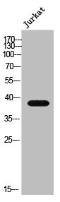 Anti-FAM84B