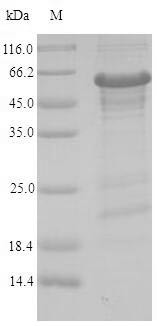 Zinc finger protein 638 (ZNF638), partial, human, recombinant