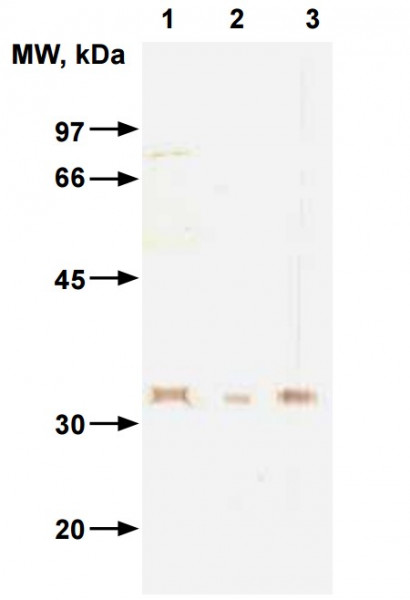 Anti-Influenza B haemagglutinin, clone InB190
