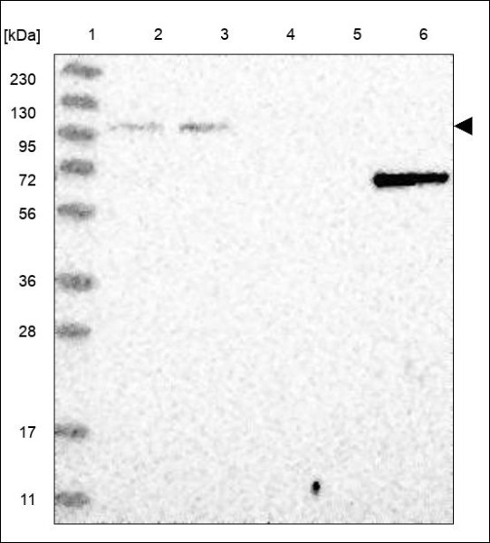 Anti-NUP107
