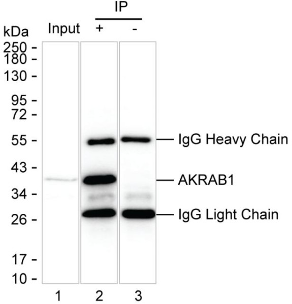 Anti-AKR1B1
