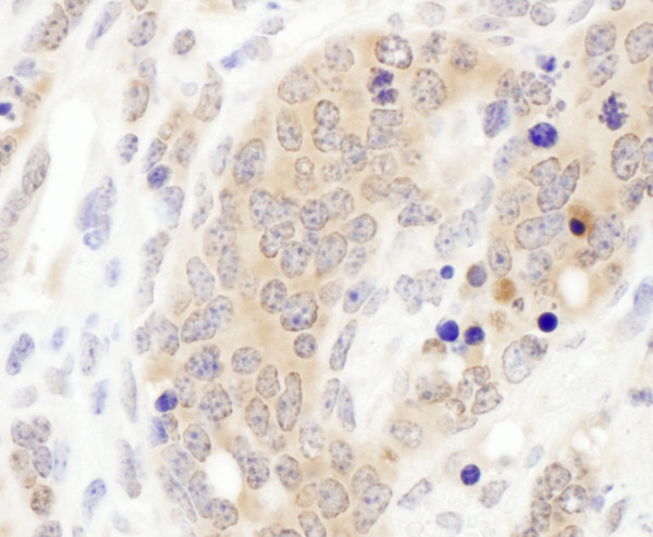 Anti-CCT3