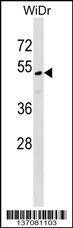 Anti-MLF1IP, CT (MLF1IP, CENPU, ICEN24, KLIP1, PBIP1, Centromere protein U, Interphase centromere co