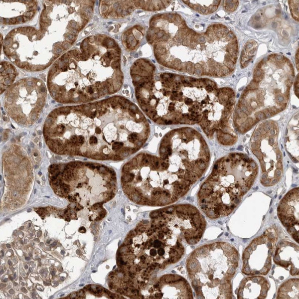 Anti-WNT16