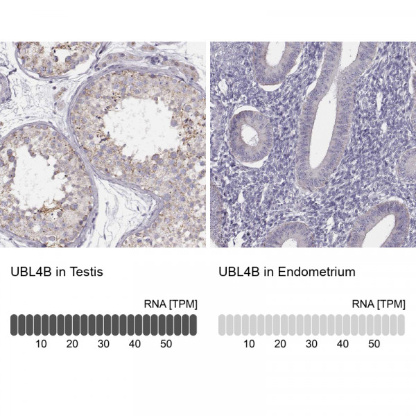 Anti-UBL4B