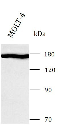 Anti-PDS5B