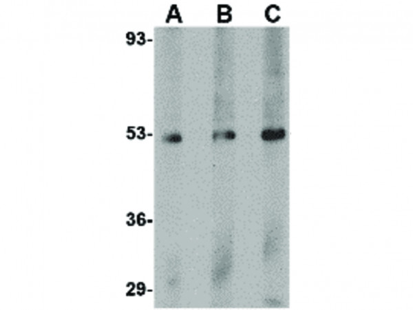 Anti-TEM7
