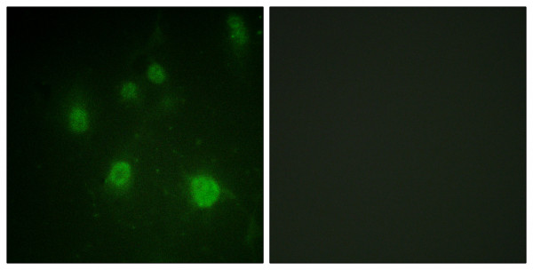 Anti-phospho-HMGN1 (Ser21)