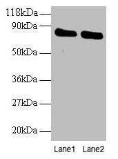 Anti-OTUB1