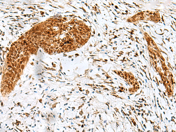 Anti-HMG20A