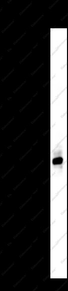 Anti-Recombinant ENOA, clone C111922