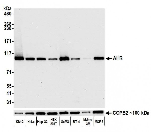 Anti-AHR Recombinant Monoclonal