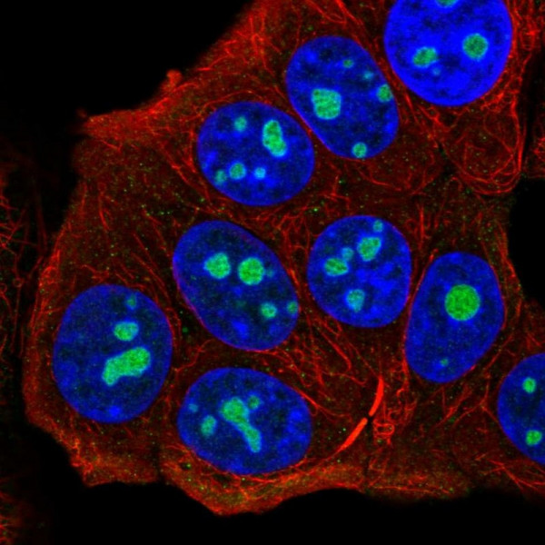 Anti-UTP14C